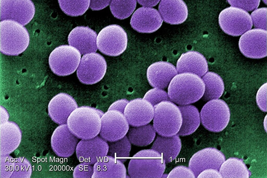 Purple clusters of bacteria