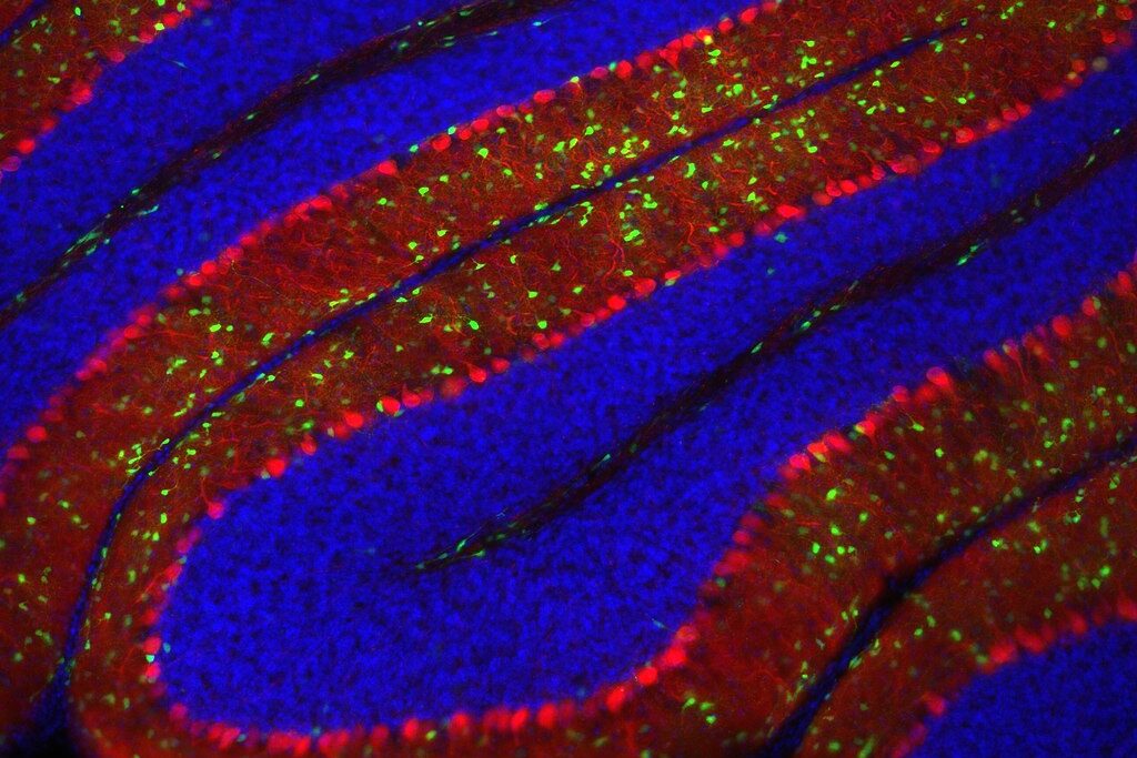 Part of a mammalian cerebellum