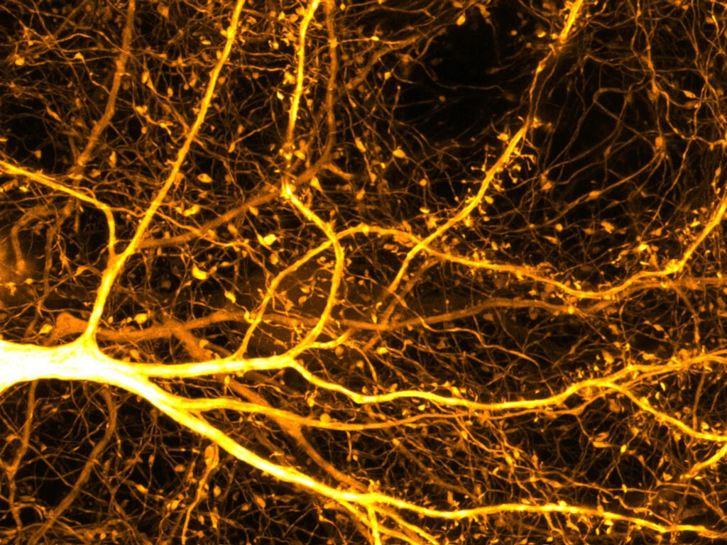 A neuron illuminated in yellow against a black background.
