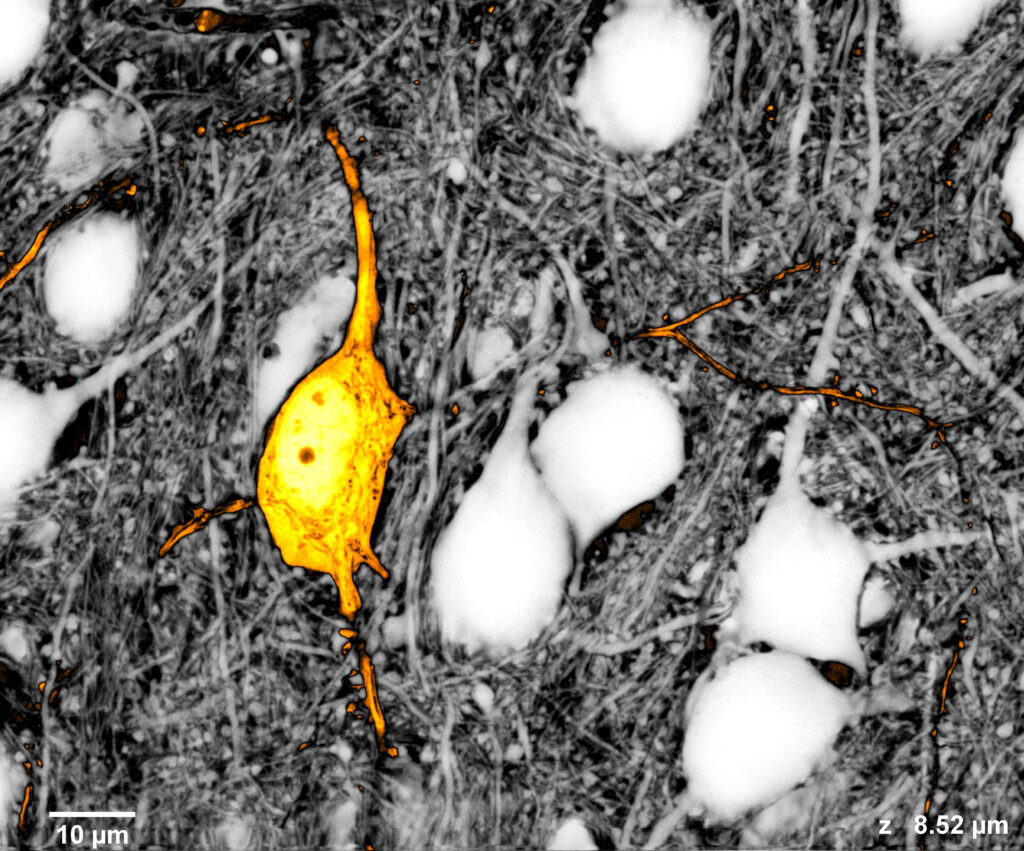 A microscope image of a neuron.