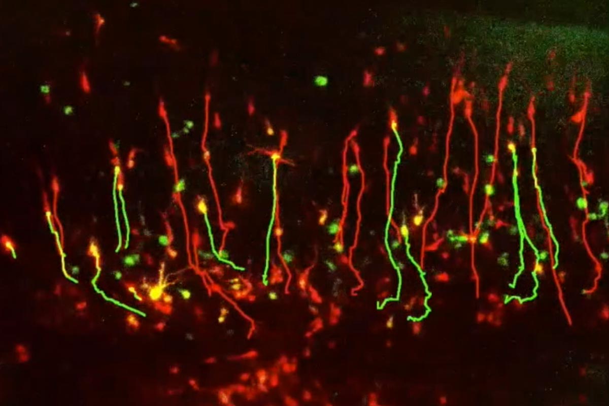 Tracks of expressing neurons shown aligning linearly.