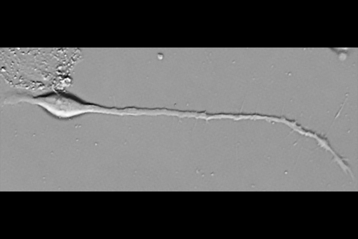 Image shows the growing axon of a mouse dorsal root ganglion sensory neuron in vitro turning away from the extracellular signaling molecule WFIKKN2.